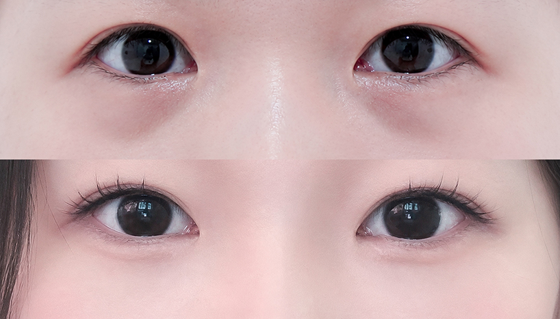 전후사진