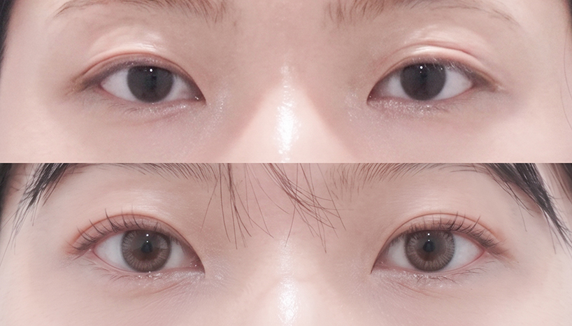 전후사진