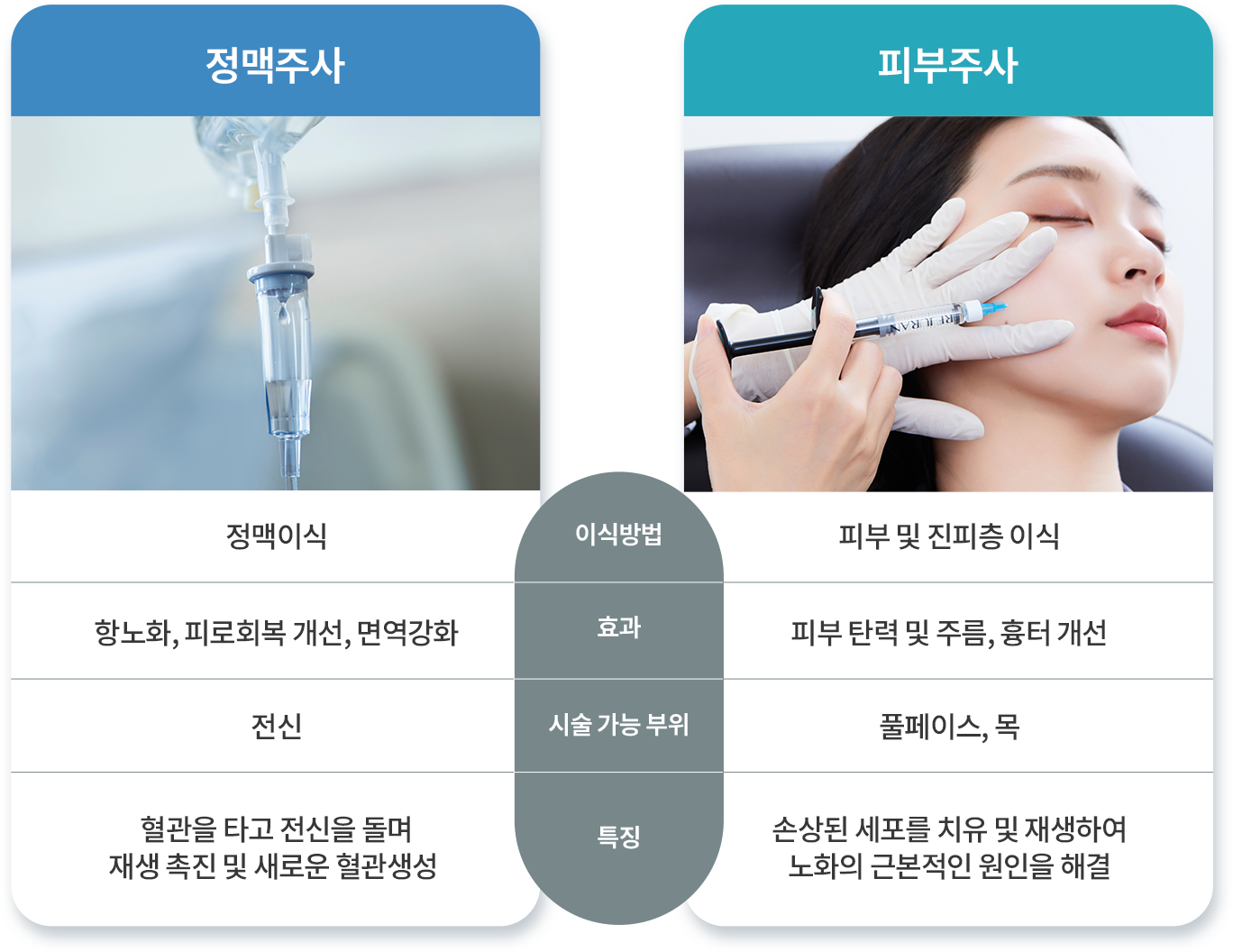 줄기세포 시술방법