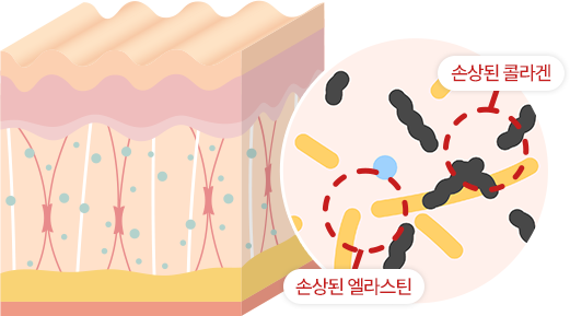 브라운 줄기세포 피부주사